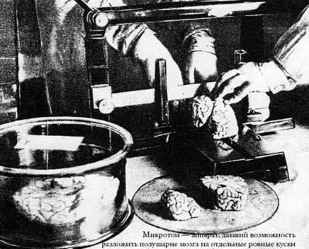 Mikronomas - prietaisas smegenims pjaustyti