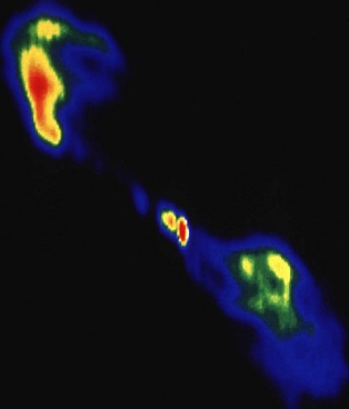 Kentauro Alfa (NGC 5128) galaktika